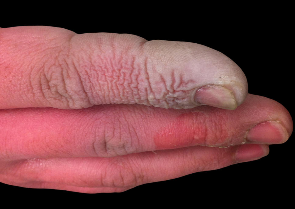 计为SIL2认证Flap-11C磁翻板液位计保障衡阳氢氟酸安全精确测量